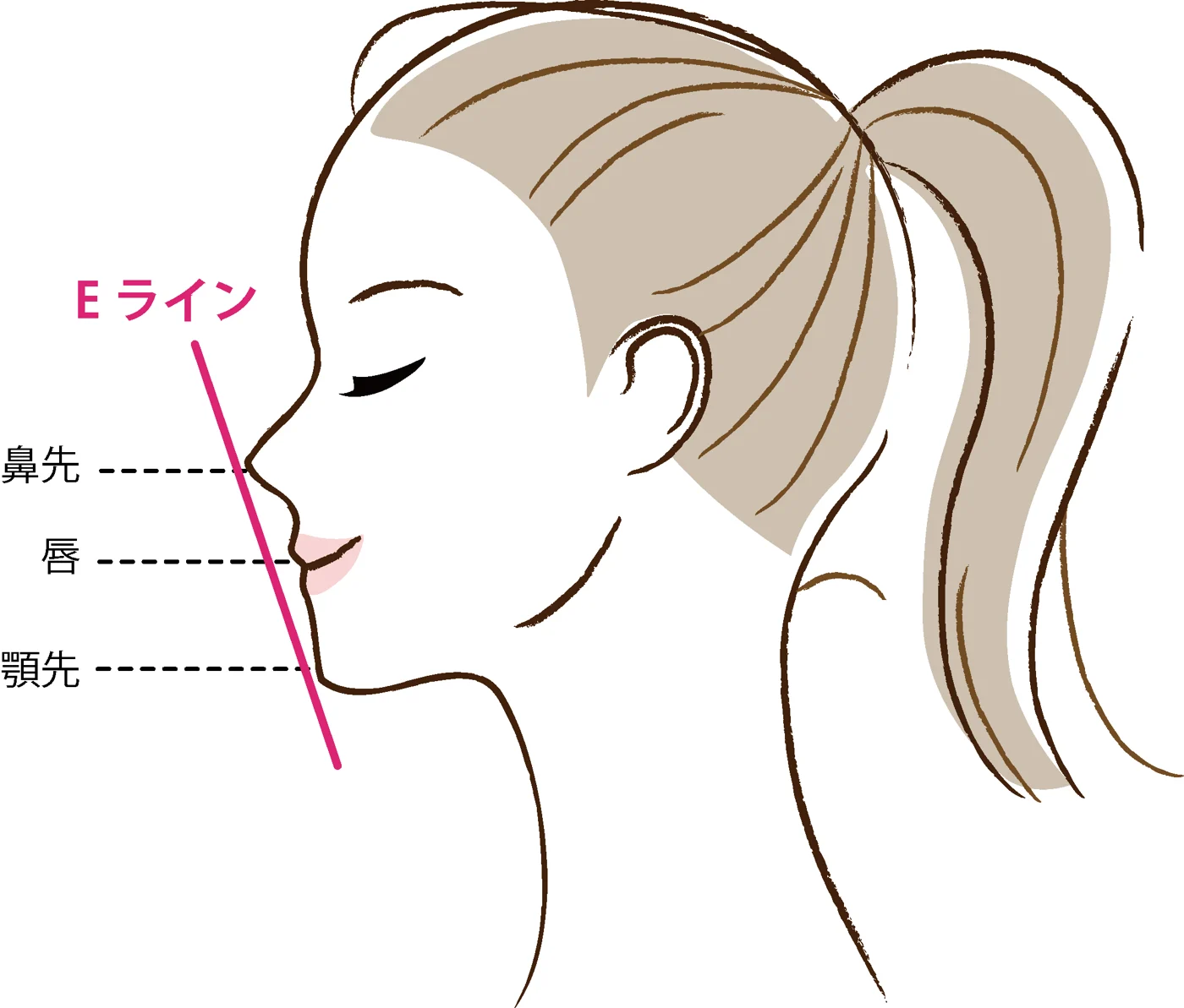 口ゴボの矯正後に期待できる変化とは?改善プロセスと注意点を解説【静岡歯科が解説!】の参考画像